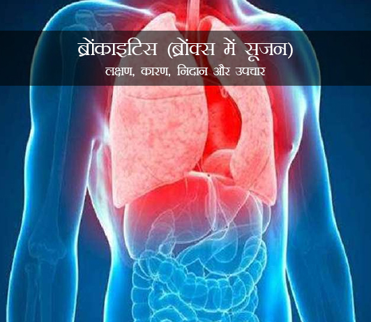 Bronchitis in Hindi Bronchitis in Hindi