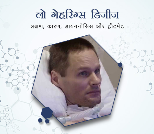 1 Lou Gehrig’s Disease (Amyotrophic Lateral Sclerosis, ALS) in Hindi लो गेहरिग्स डिजीज (एमियोट्रोफिक लेटरल स्क्लेरोसिस, एएलएस): लक्षण, कारण, डायगनोसिस और ट्रीटमेंट