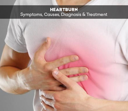 6 Heartburn: Symptoms, Causes, Diagnosis & Treatment