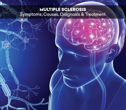 7 Multiple Sclerosis: Symptoms, Causes, Diagnosis & Treatment