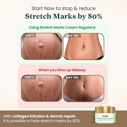 Healofy Naturals Stretch Mark Cream Scar removal and Moisturizing Cream