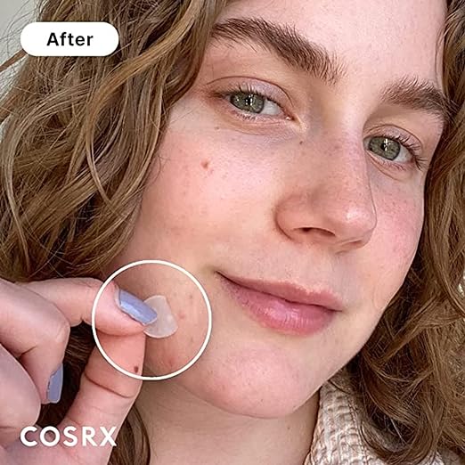 Cosrx Acne Pimple Master Patches