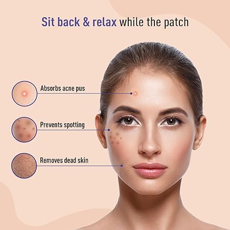 Sirona Anti Acne Pimple Patches for Face