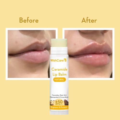 Wishcare Ceramide Lip Balm With Spf50 Pa+++ - Kojic Acid & Niacinamide - For Lip Lightening & Protection