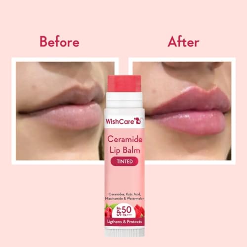 Wishcare Tinted Ceramide Lip Balm With Spf50 Pa+++ - Kojic Acid & Niacinamide - For Lip Lightening & Protection