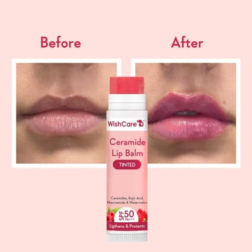 Wishcare Tinted Ceramide Lip Balm With Spf50 Pa+++ - Kojic Acid & Niacinamide - For Lip Lightening & Protection