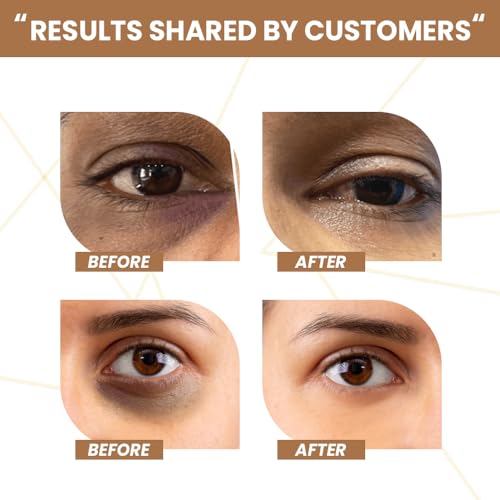 Rawls Coffee Under Eye Cream with 360 Massage Roller