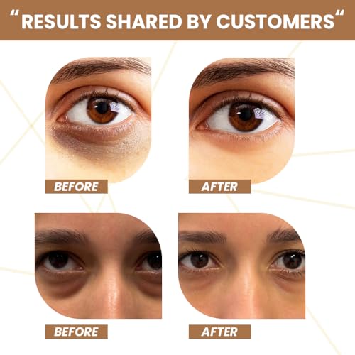 Rawls Coffee Under Eye Cream with 360 Massage Roller