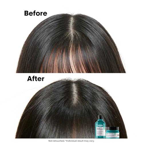 L'Oreal Professionnel Scalp Advanced Anti Oiliness 2 in 1 Deep Purifier Clay | Salon Care Scalp Mask with 3 Percent AHA