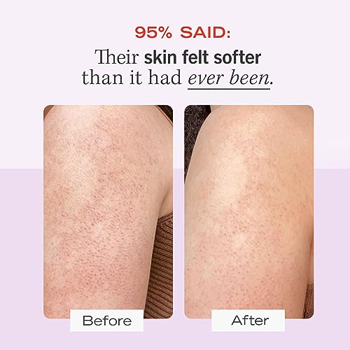 First Aid Beauty KP Bump Eraser Body Scrub w. 10% AHA | For All Skin Types
