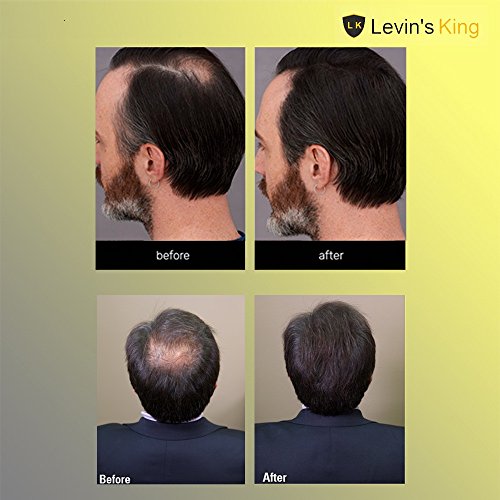 Levins King Hair Building Fiber | Hair fibre Concealer Refill Pack Use For All hair fiber like Caboki | Dark Brown