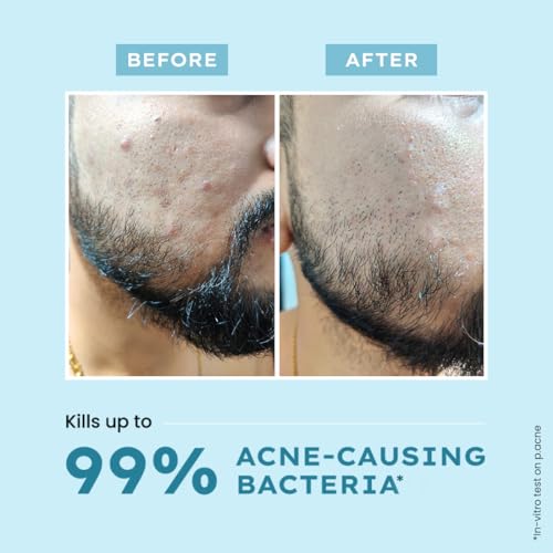 Hyphen Clarifying Acne Cleanser With 2% Salicylic Acid Face Wash For Acne Prone Skin