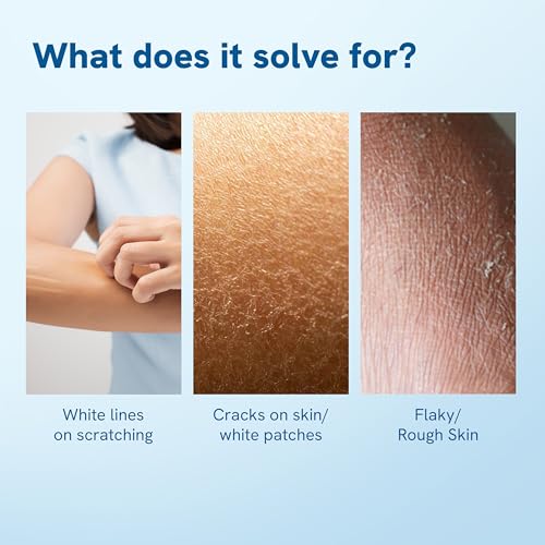 Bodywise 10 Percent Urea Body Lotion | Intensive Hydration for Rough and Dry Skin