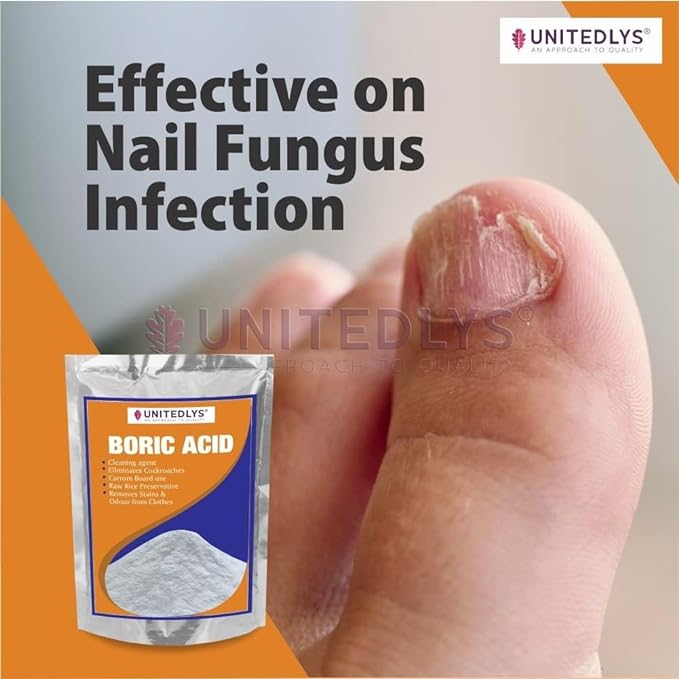 Unitedlys Multi-Purpose Boric Acid Powder