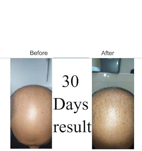 Green Wealth Neo Hair Lotion