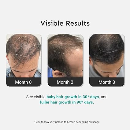 Arata Intensive Hair Growth Serum - 3% Redensyl | 3% Procapil | Hair Fall Control