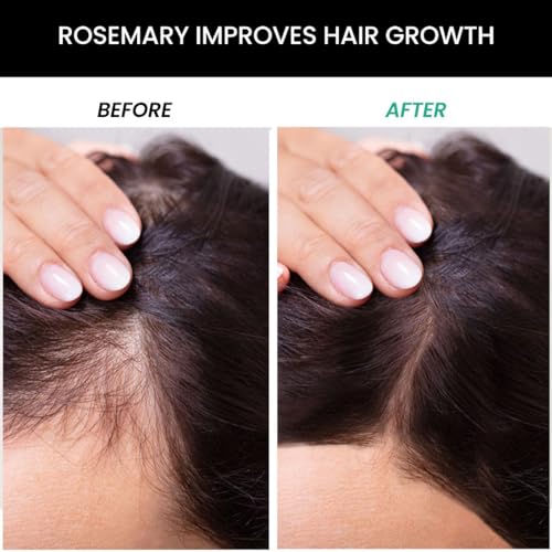 ThriveCo Hair Vitalizing Rosemary Shampoo For Hair Fall Control Daily Use Mild Shampoo For Hair Growth With Caffeine & Zinc PCA