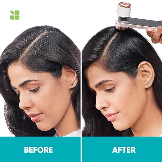 Biolage Scalppure Professional Anti-Dandruff Shampoo