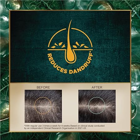 Indulekha Dandruff Treatment Shampoo