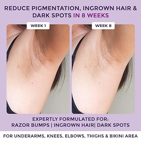 Sanfe Spotlite Ingrown Hair & Bumps Clearing Body Scrub For Dark Underarms, Inner Thighs and Sensitive Areas
