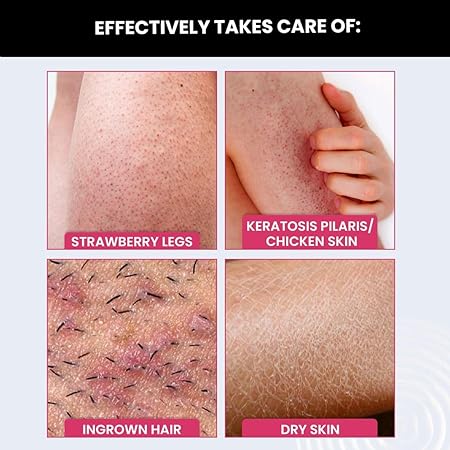 ThriveCo Bumps Smoothening Eraser Exfoliating Scrub For Rough & Bumpy skin