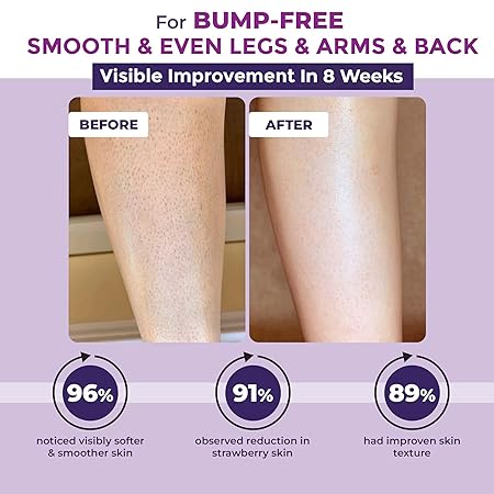 Sanfe Reveal No More Bumps Erasing Body Scrub For Rough & Bumpy Skin
