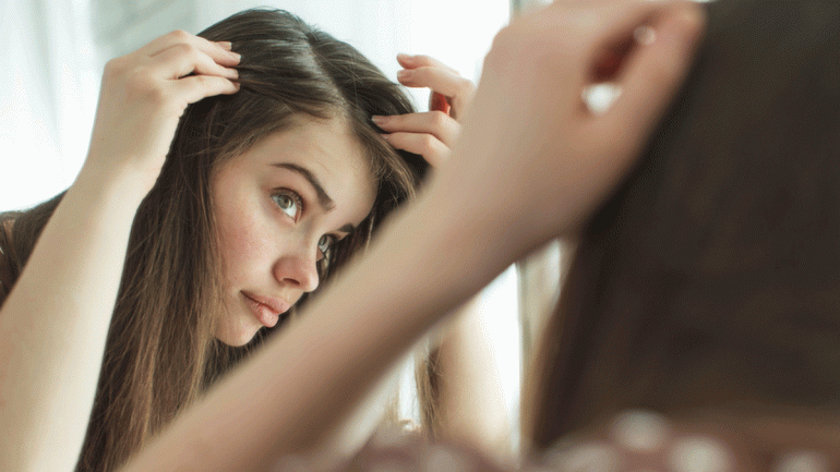 How To Get Rid Of White Hair In 8 Easy Ways Treating Premature